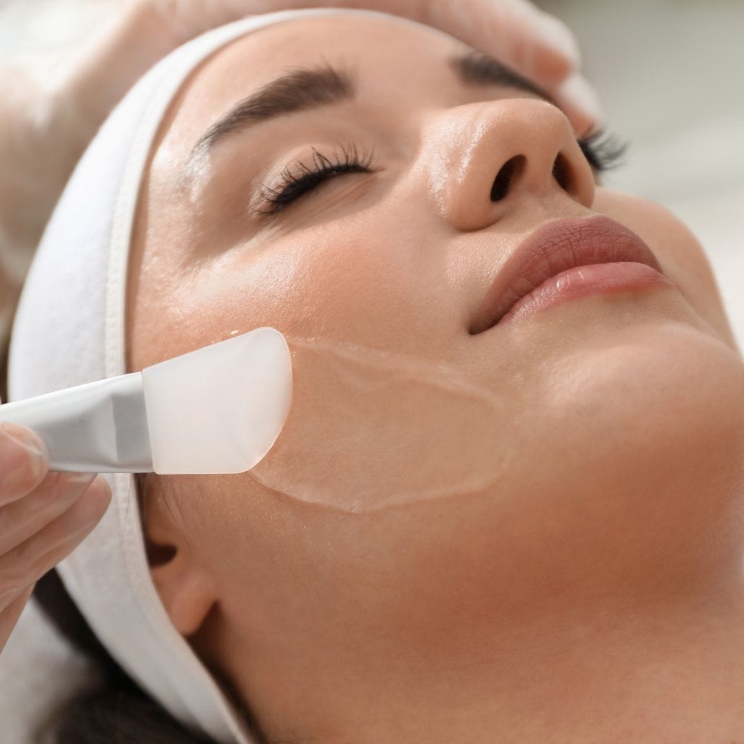 Soothing solutions after a chemical peel