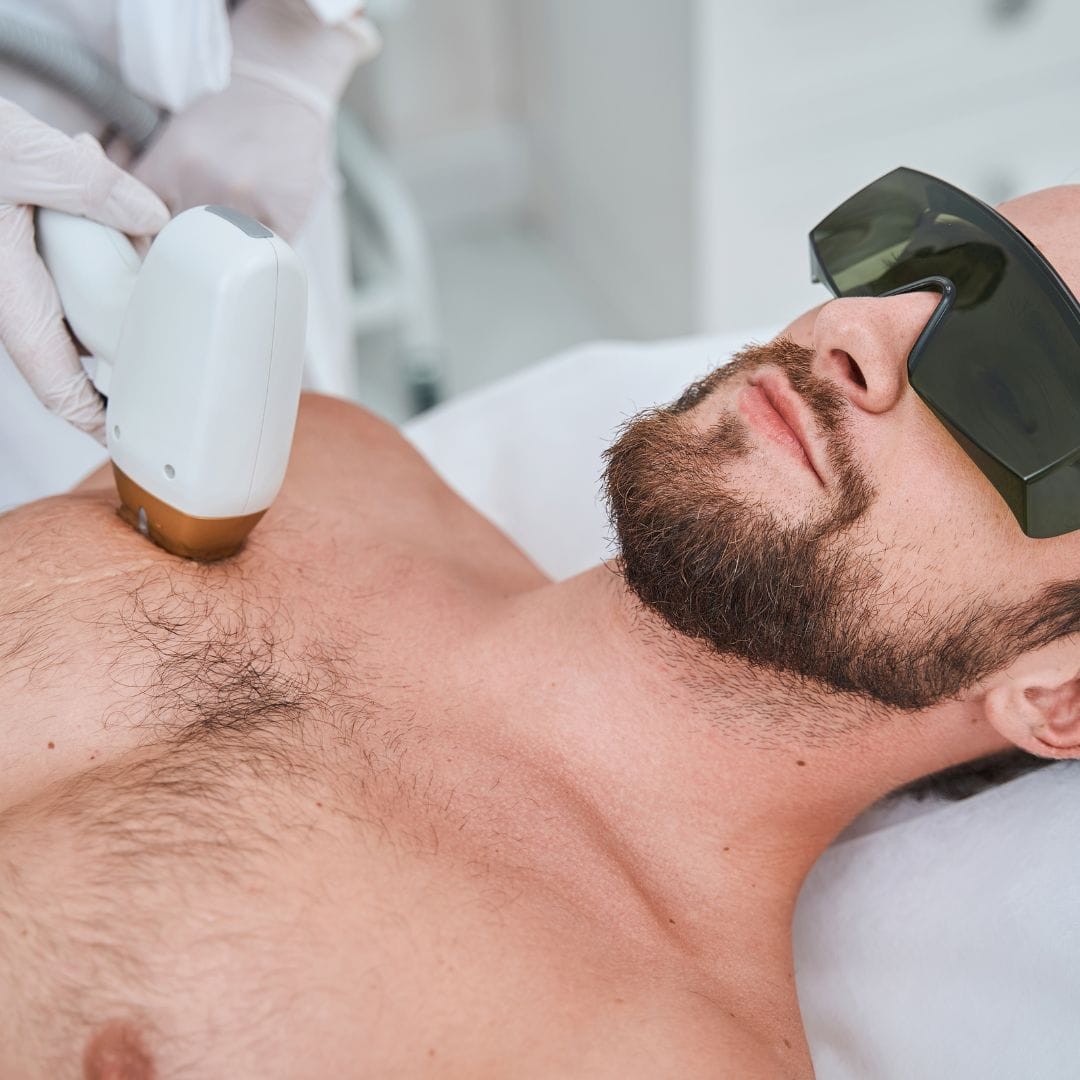 Laser Hair Removal for Men