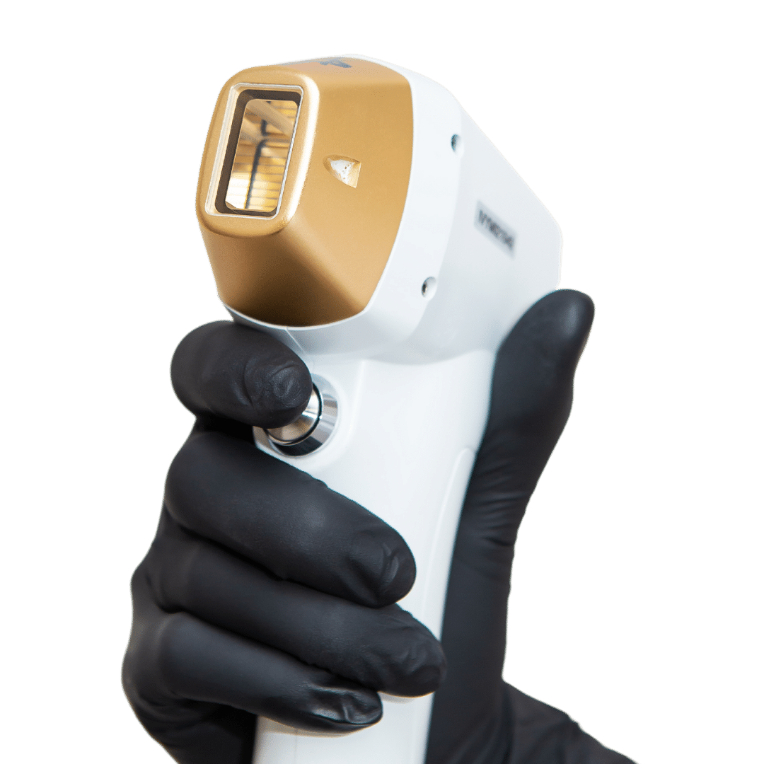 Laser Skin Rejuvenation