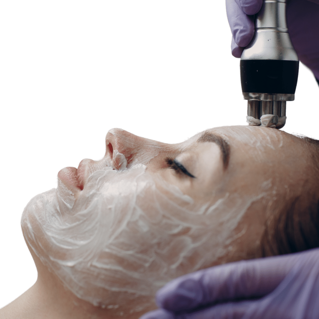 Radio Frequency Facial