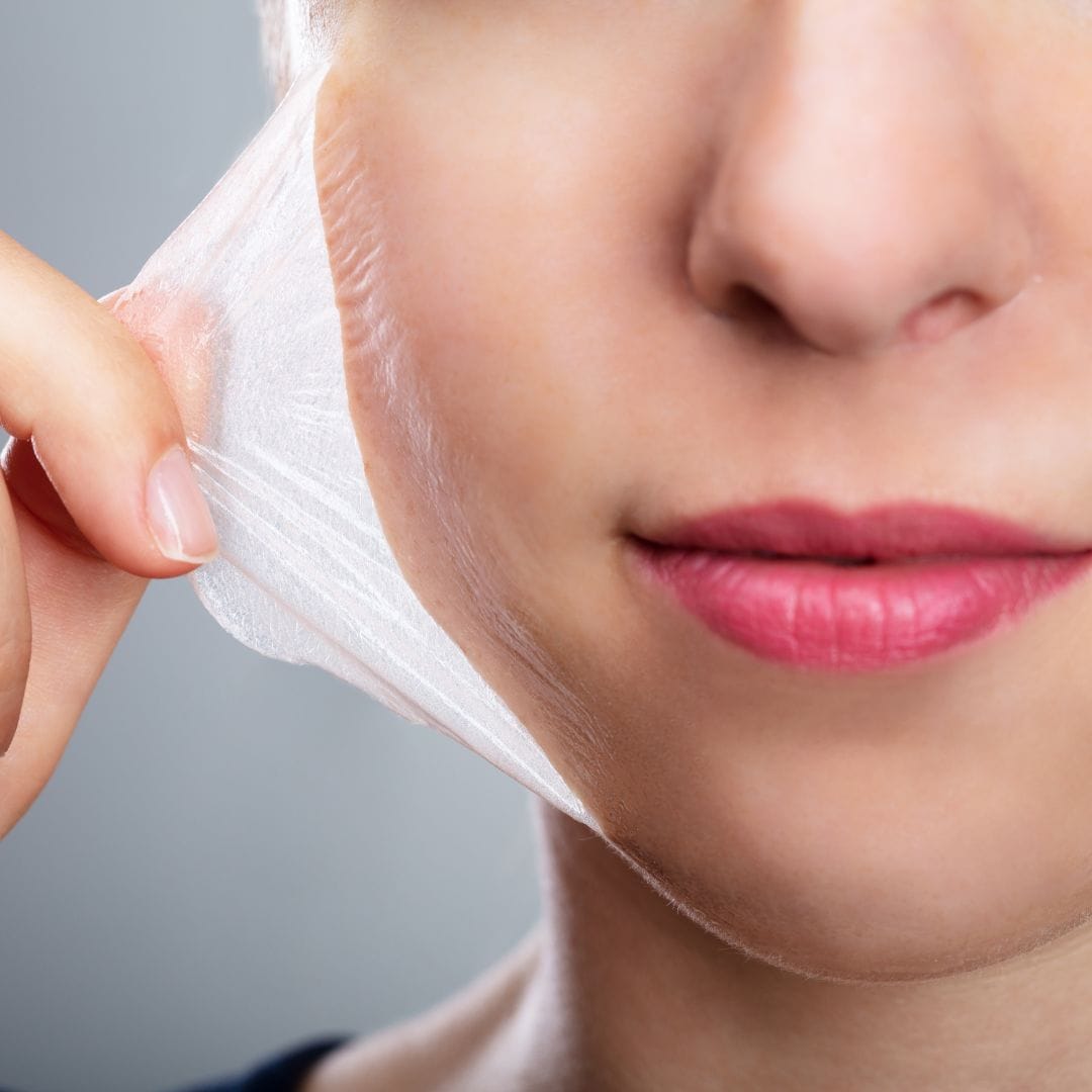 Top Tips For Having A Peel